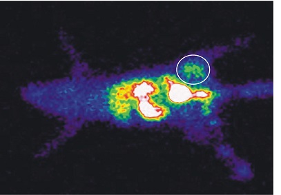 Imagem cintilográfica com aptâmeros radiomarcados